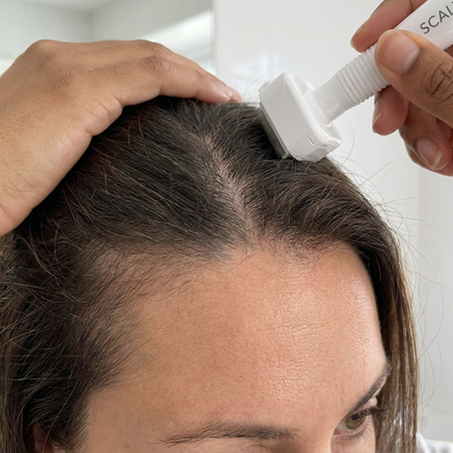 Scalvique™ Adjustable Scalp Stamp